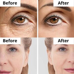 Vitamin A skin cream anti-aging and anti blemish